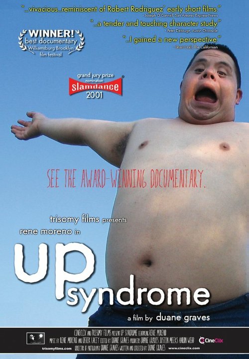 Up Syndrome